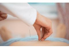 Electroacupuncture NYC